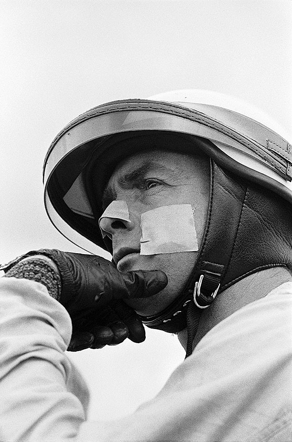 Phil Hill, plaster covers a stone chip lesion